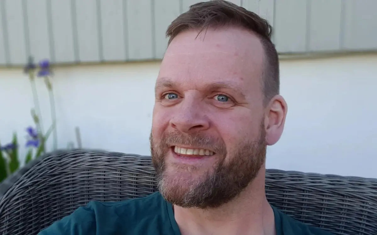 Remi fikk tilbake selvtilliten med denne permanente løsningen for hårfjerning